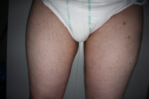 bl