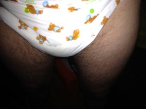 photo-1